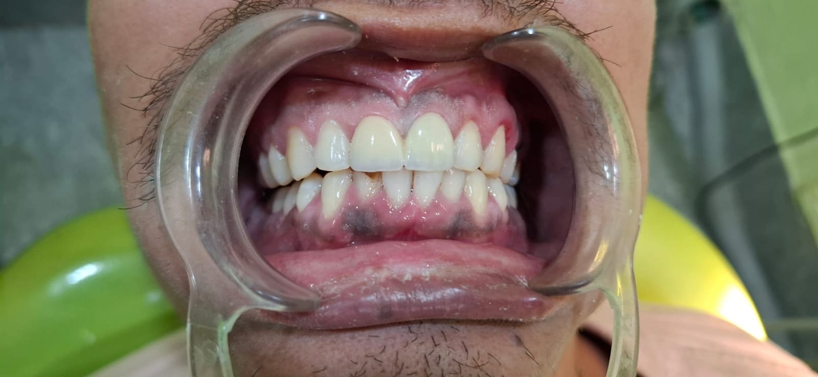 Patient Transformation 2