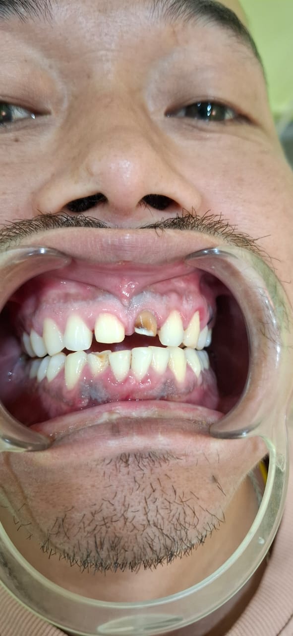 Patient Transformation 1