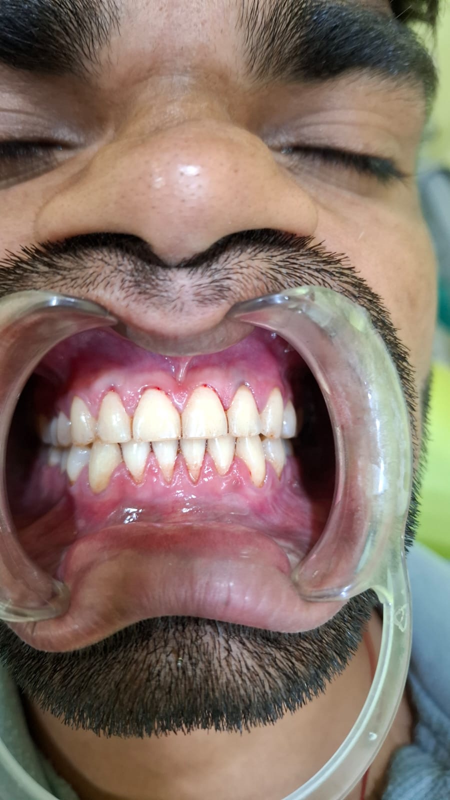 Patient Transformation 4